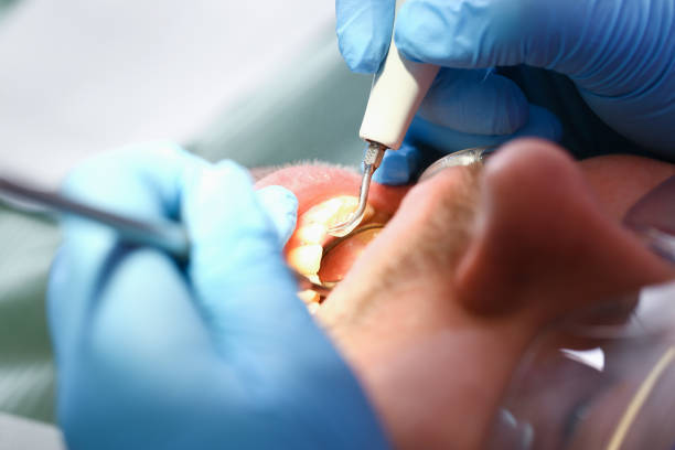 Best Emergency Denture Repair in Soquel, CA