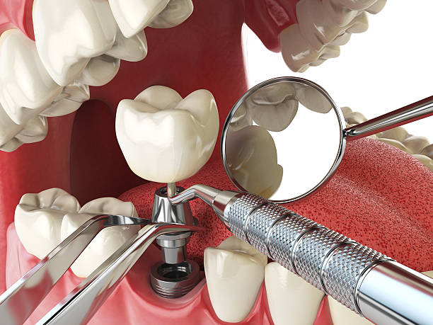 Best Cosmetic Emergency Dentistry in Soquel, CA